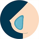 gel-breasts